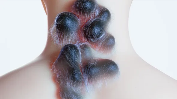 Houdini皮肤病态生长动画特效实例制作视频教程 Stylized Skin Growth in Houdini